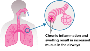 lungs